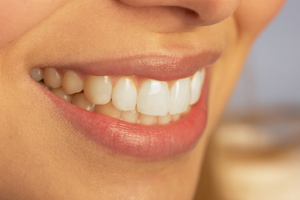 smiling teeth cosmetic