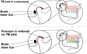 Under Armour Mouthwear Science