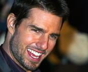 Invisalign-Treatment-Tom