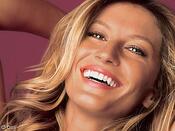 Invisalign-treatment-Gisele